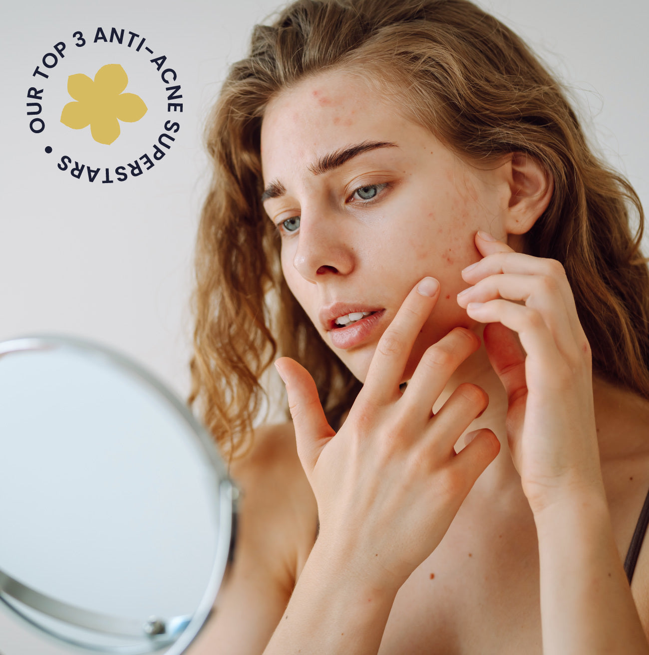 Best Skincare Products for Acne-Prone Skin