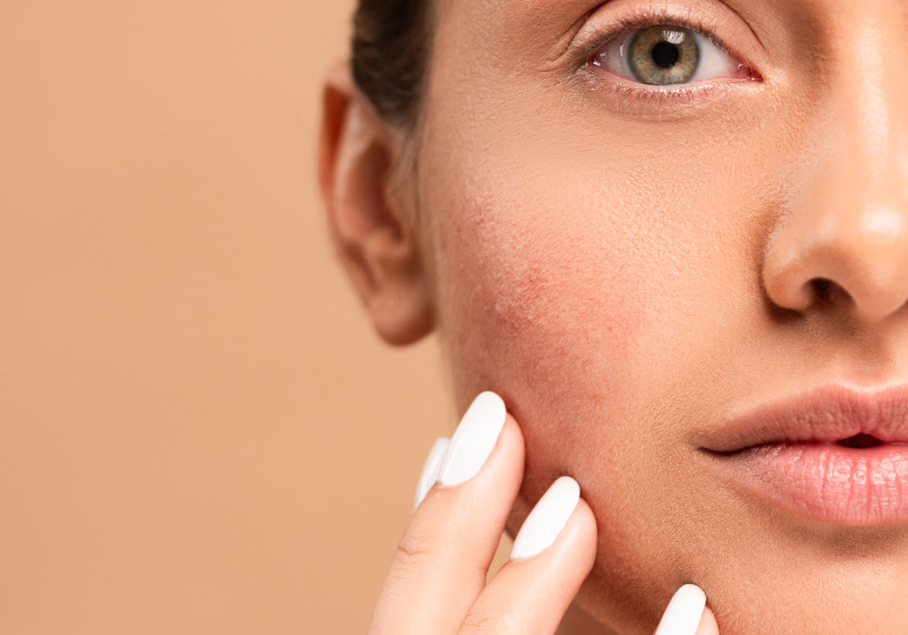 Is your Skin Sensitive or Sensitized?