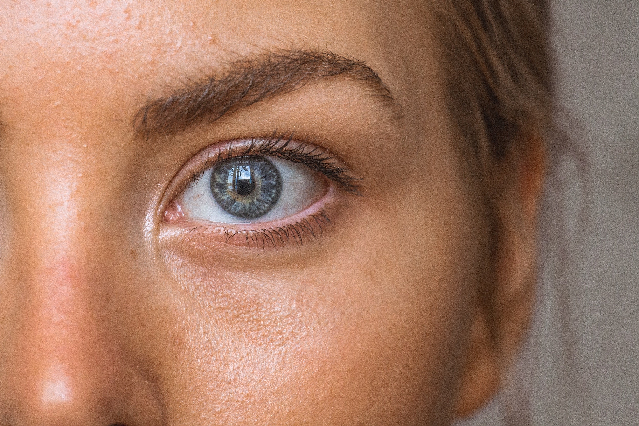 Bright Eyes Ahead: Common Causes & Solutions for Dark Under-Eye Circles